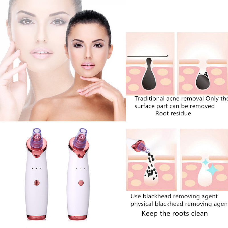Blackhead Remover Instrument Black Dot Remover Acne Vacuum Suction Face Cleaner - My Wellness Warehouse